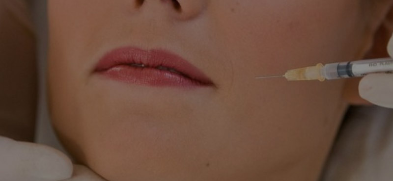 Botox para Bruxismo