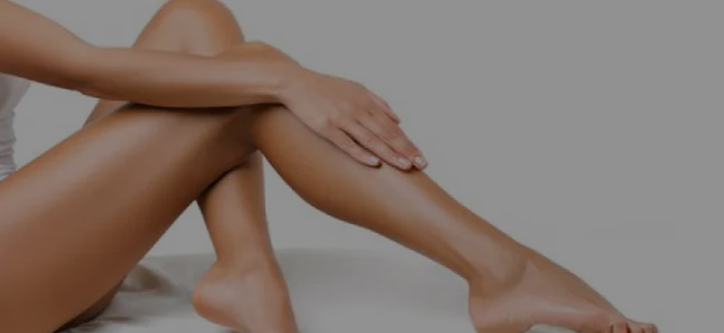 Escleroterapia
