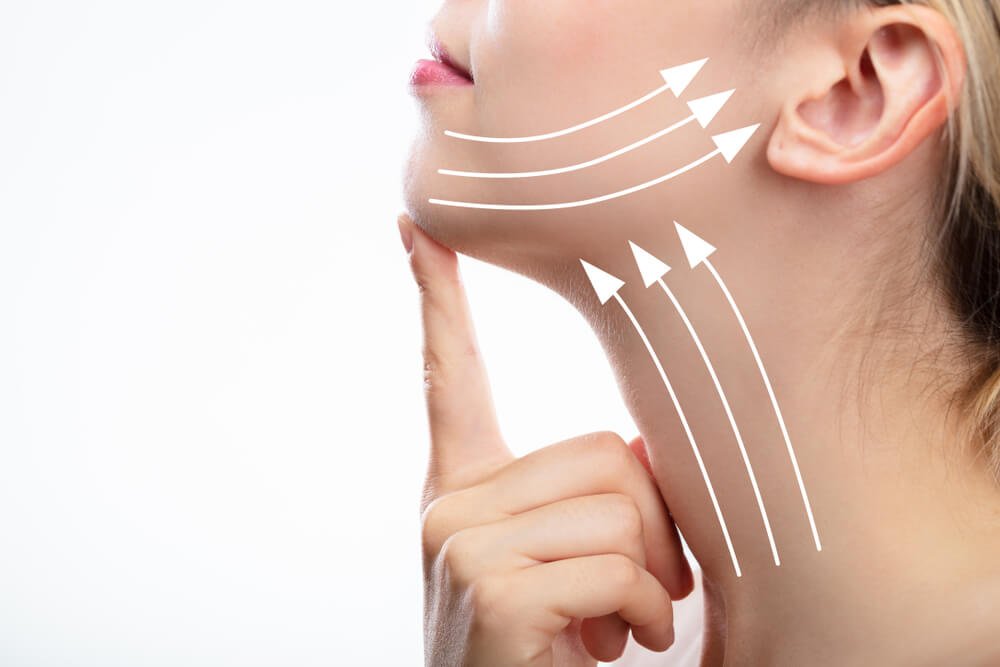 Lifting-De-Cara-Y-Cuello Lifting-De-Cara-Y-Cuello