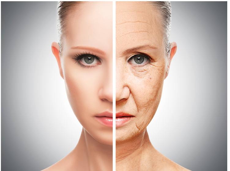 botox